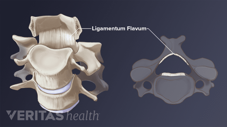 Illustration of the ligamentum flavum
