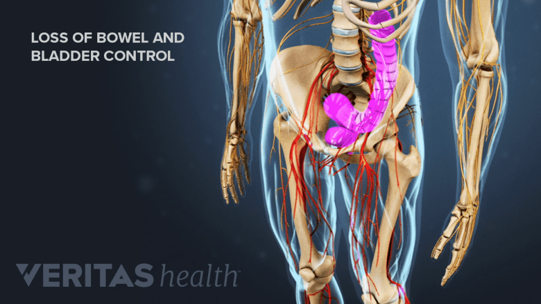 Illustration showing pelvic area with bowe and bladder highlighted in pink.