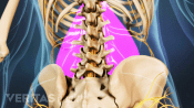 Medical illustration of the lower spine. The muscles are highlighted, to indicate muscle strain