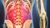 Posterior view of the lumbar spine with pain in lower back.