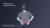 An illustration showing a woman holding her back with trigger points highlighted in red.