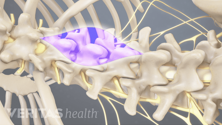 Posterior view of the location of a lumbar back incision.