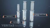 Three syringes showing three injection components, contrast dye, anesthetic, and steroid injection mixture