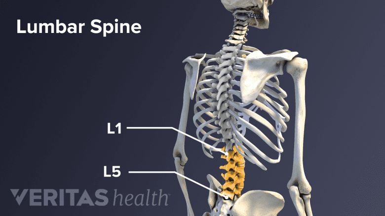 Illustration of the lower back with spine and lumbar vertebrae highlighted.
