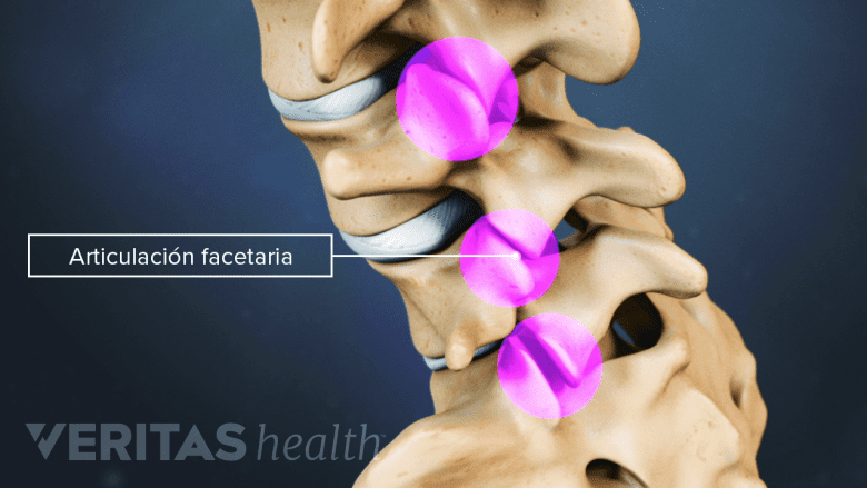La articulación facetaria en las vértebras.
