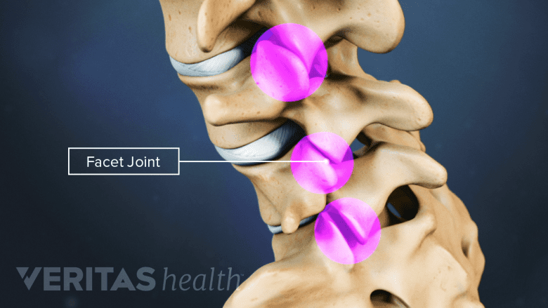 An illustration showing facet joint in the vertebrae.