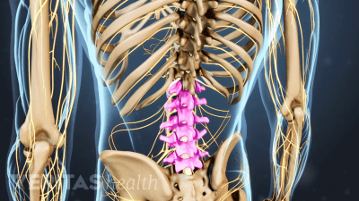 Posterior view of the lower back highlighting the lumbar spine.