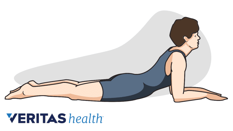 An illustration showing Mckenzie's method.