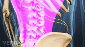 Posterior view of the lumbar spine showing pain in the lower back.
