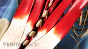 Medical illustration of the muscles of the lower back