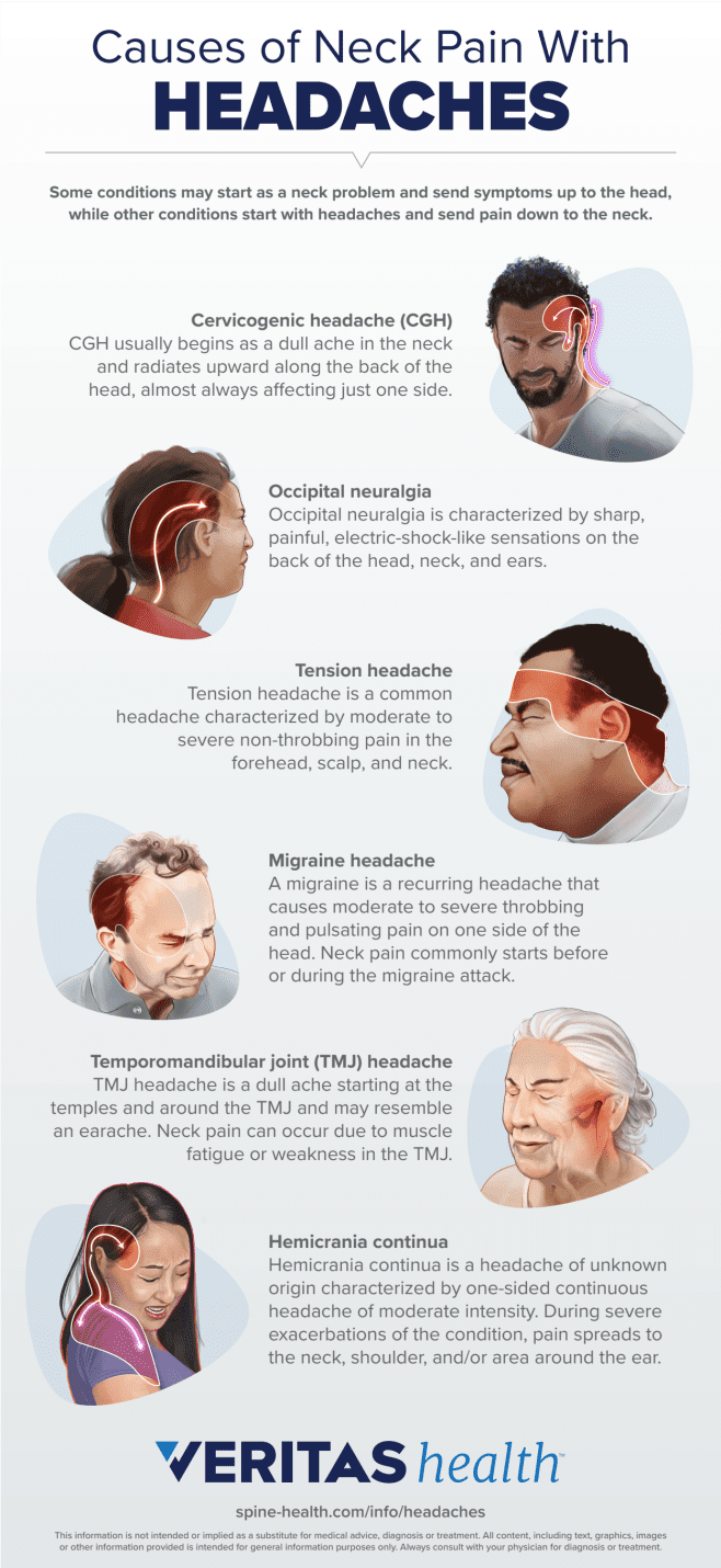Infographic of Neck Pain and Headaches Go Together
