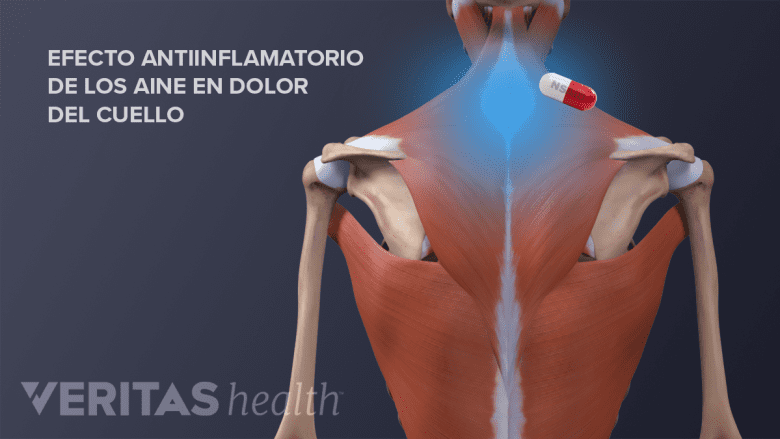 Una pastilla AINE cerca del cuello.