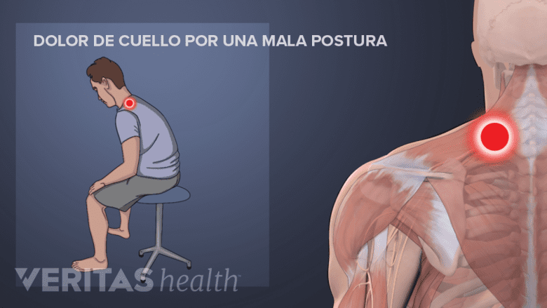 Un hombre con dolor de cuello por una mala postura.