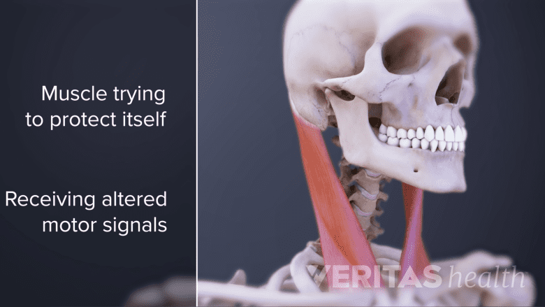 Medical illustration of neck muscles.