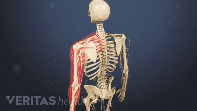 Illustration showing a skeleton with one arm highlighted in red.