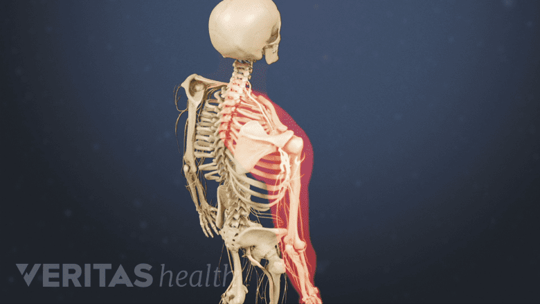 Illustration of a skeleton showing neck and arm highlighted in red.