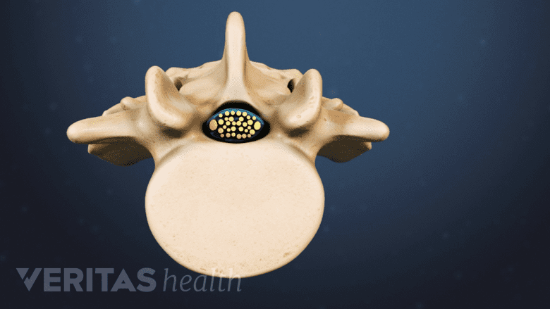 Transverse cross section view of a lumbar vertebra and spinal canal.