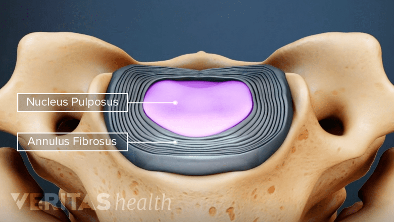 Top down labeled view of a cervical disc.