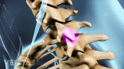 Facet joints highlighted in the cervical spine