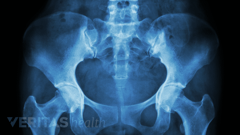 X-ray of lumbar spine and pelvis.