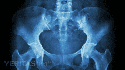 X-ray of the human pelvic bone.