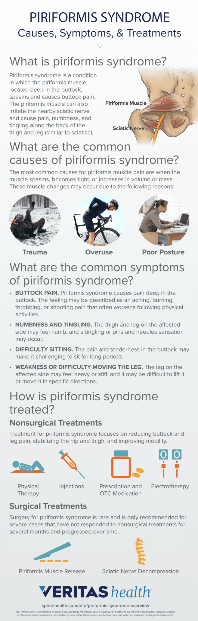 Piriformis Syndrome Overview