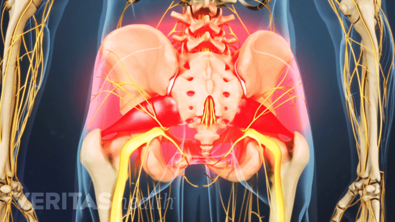 illustration showing lower back pain.