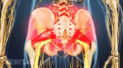 Highlighting the pain area of piriformis syndrome in the lower back, buttocks and hip area