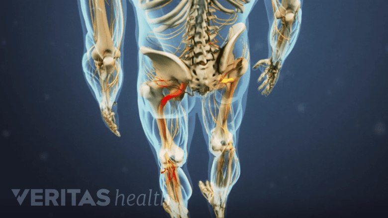Sciatic nerve and its branches in both legs.