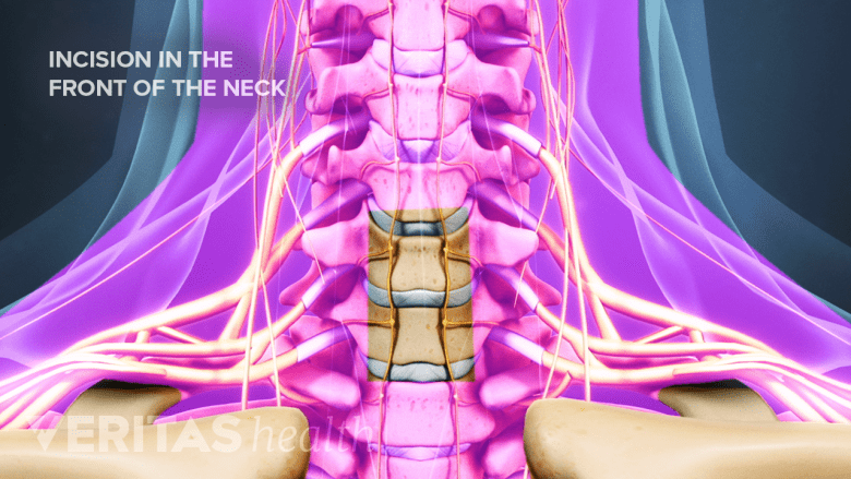 Illustration showing anterior view of cervical spine.