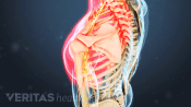 Medical illustration of the upper body, with one shoulder highlighted in red showing nerve pain in the shoulder and arm