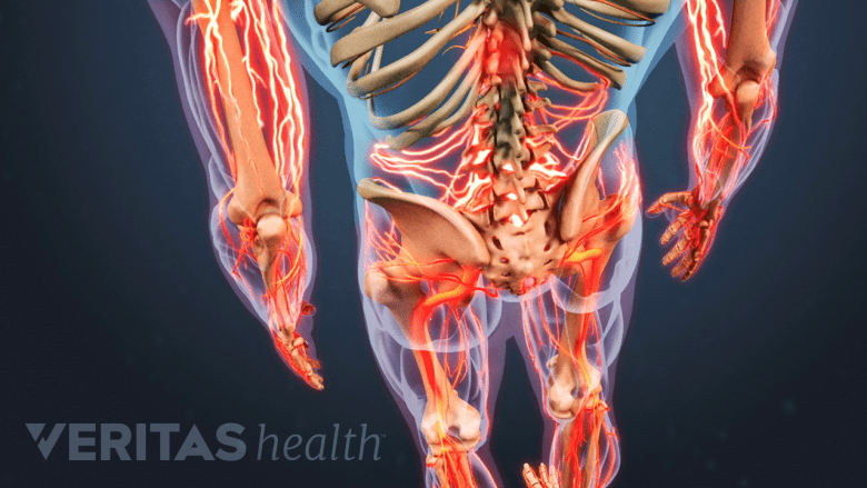3D posterior diagram of nerves in the back and extremities in red.