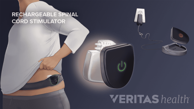 Rechargeable spinal cord stimulator charging belt for the lower back.