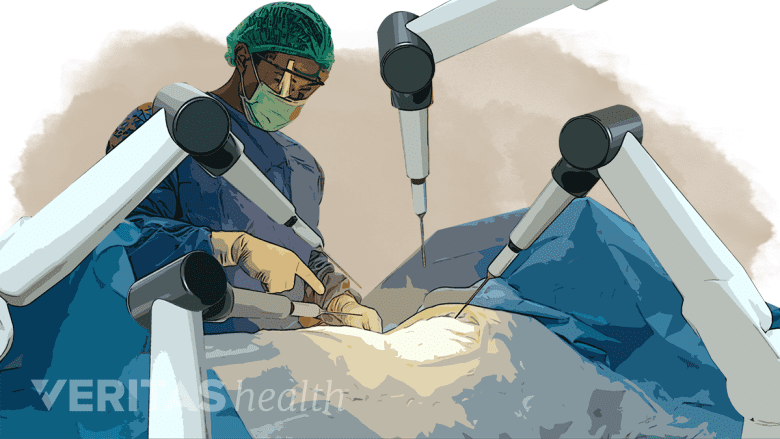 An illustration showing a doctor performing surgery in the operating room.
