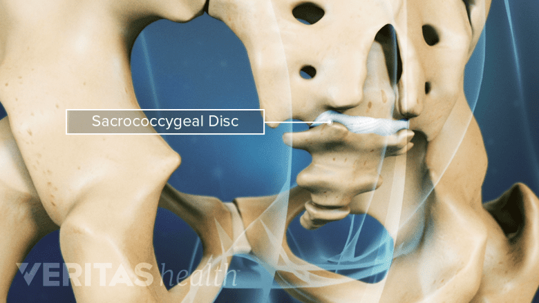 An illustration of sacrococcygeal disc in white.
