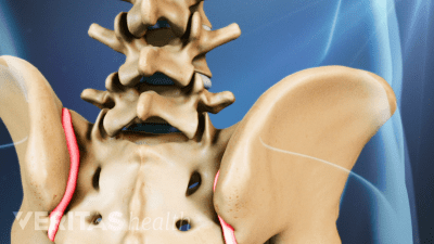 Posterior view of the pelvis showing pain in the SI joints
