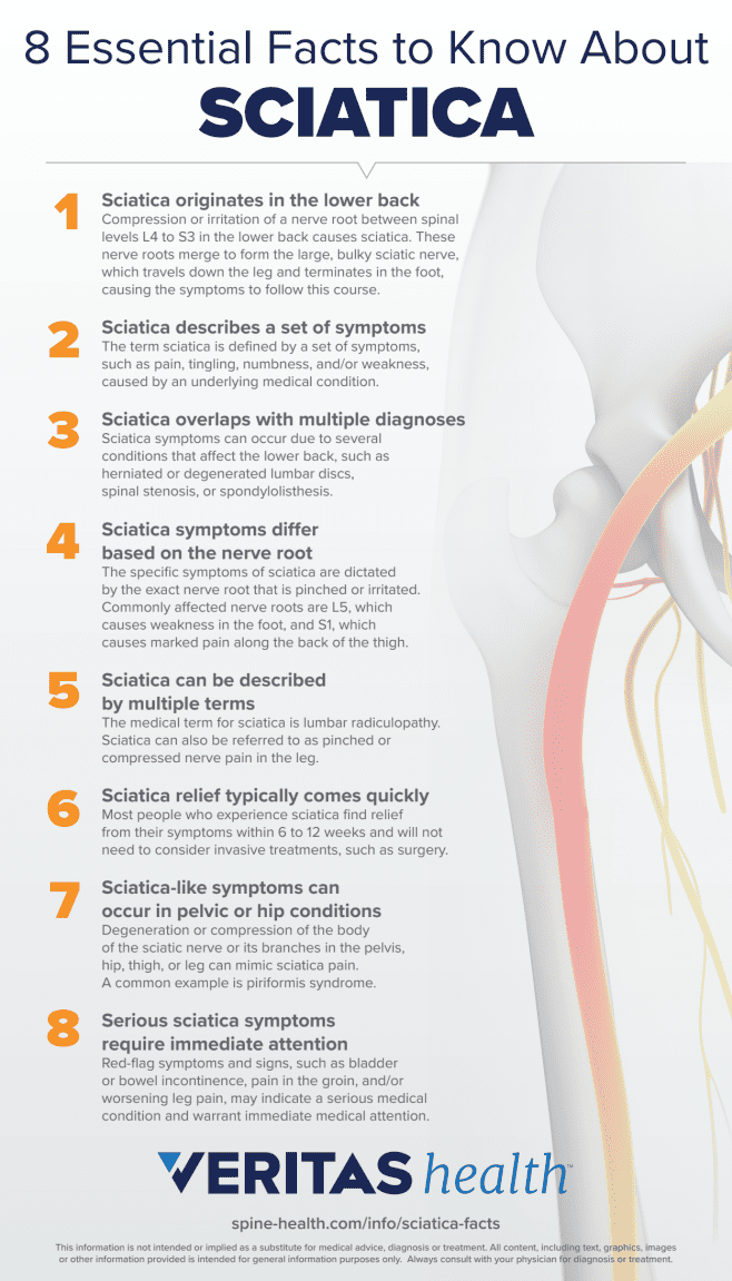 8 Essential Facts to Know About Sciatica