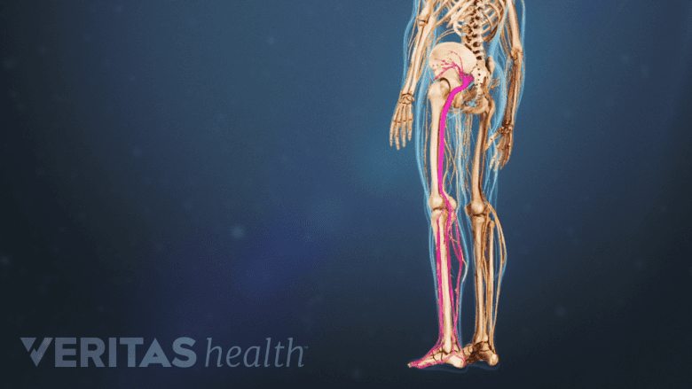 Human body with the sciatic nerve highlighted in red.