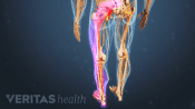 Posterior view of path of radiating pain down the leg