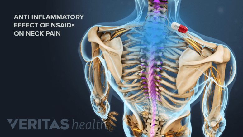 Rear view skeleton with NSAID pill near neck.