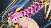 Medical illustration showing the cauda equina nerve roots in the lumbar spine