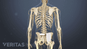 Medical illustration of a skeleton, showing the placement of a spinal cord stimulator for the lower back