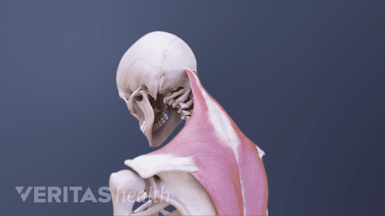 Foward head tilt neck pain