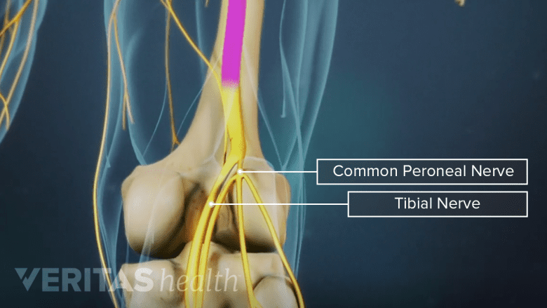 Illustration showing the knee joint with peroneal and tibial nerve.