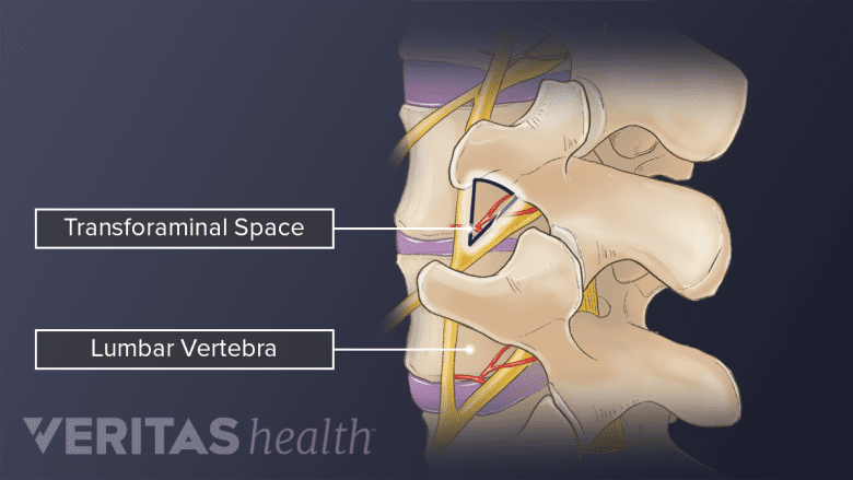 Profile view highlighting the transforaminal space in between vertebrae.