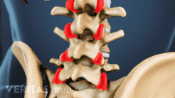 Highlighting facet joints of the lumbar spine