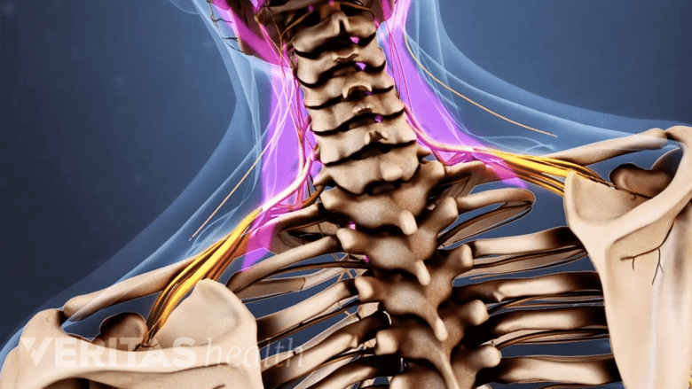 an illustration showing the neck highlighted in pink.