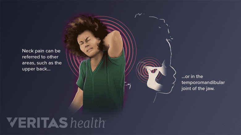 Woman grabbing neck in pain to illustrate referred pain