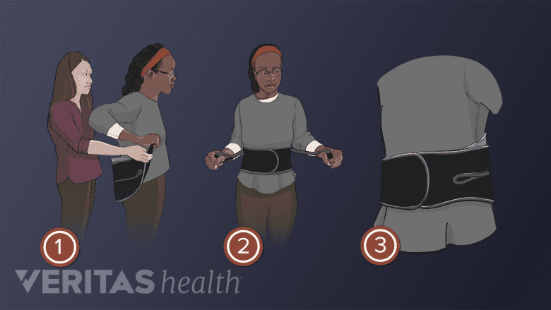 Medical illustration of 3 steps on how to put on a back brace
