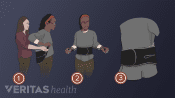 Medical illustration of 3 steps on how to put on a back brace